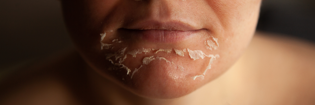 12 Ingredients To Avoid In Skincare Products